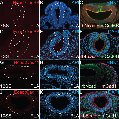 Images from a proximity ligation assay examining interactions between the focal proteins. (Figure 1, Rogers 2018)