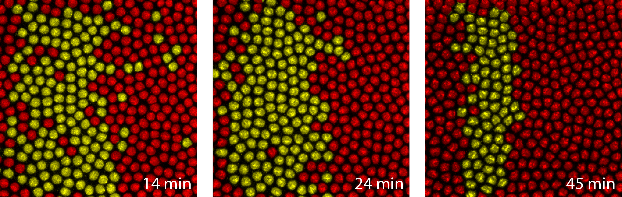 Patterns of gene expression visualized in individual cells of a fruit fly embryo (a href="http://mcb.berkeley.edu/labs/garcia/">Garcia Lab)