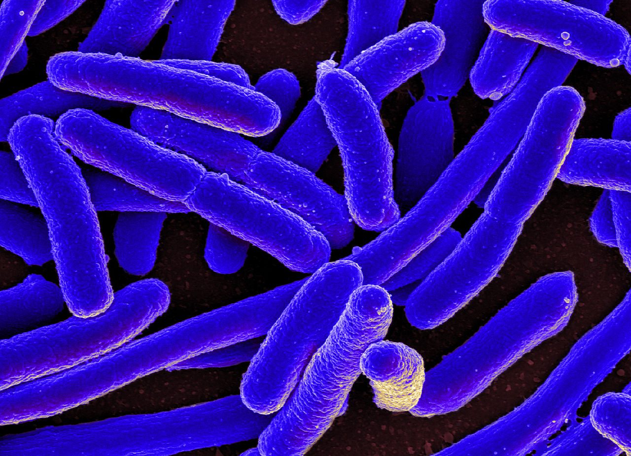 E coli cells