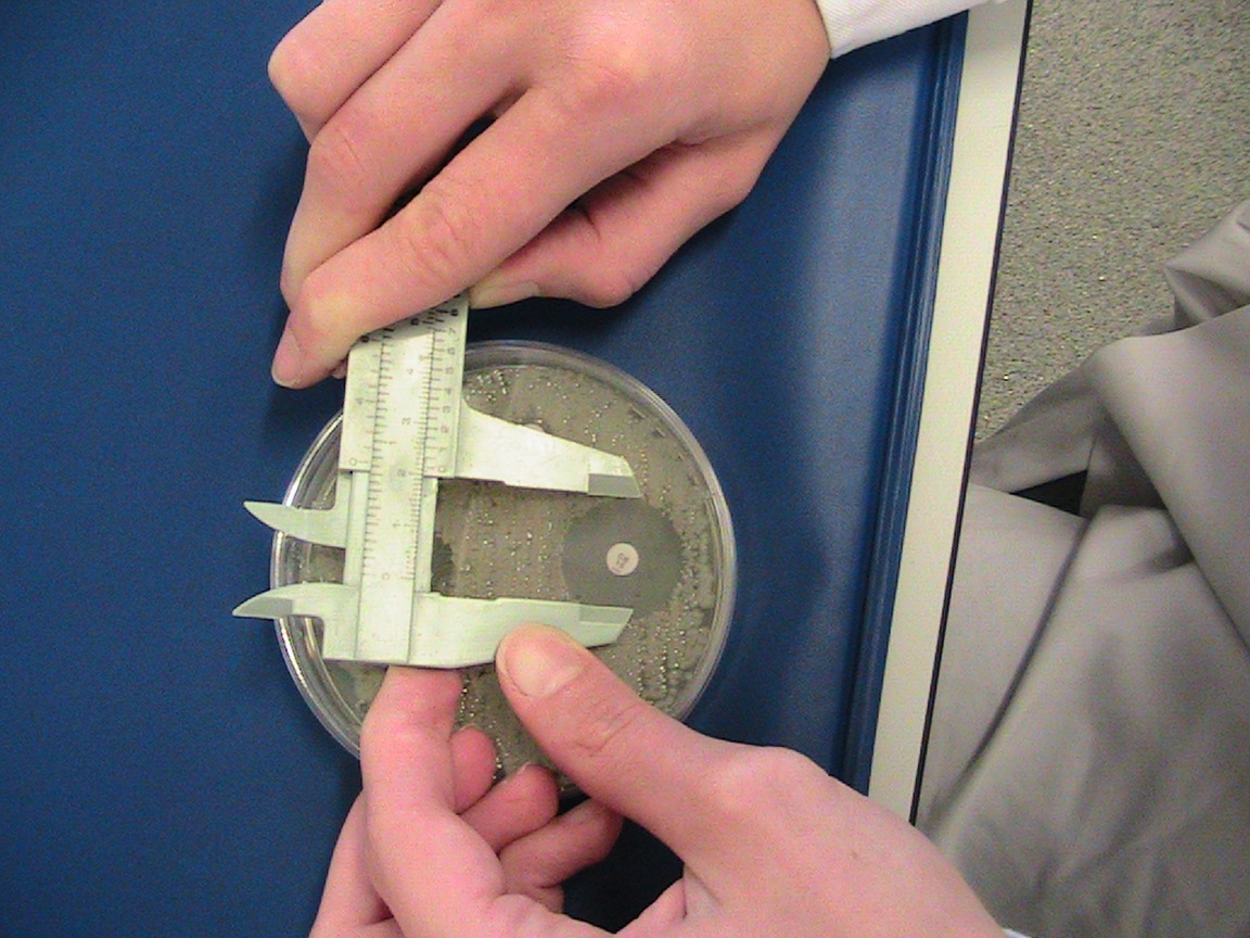 A scientist uses calipers to measure the diameter of a region without bacterial growth in the midst of bacterial colonies covering an agar plate