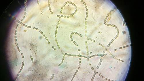 Filaments of green bacterial cells